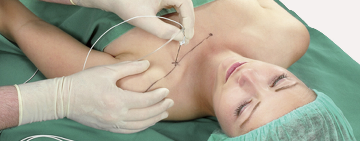 Know your Anaesthesiologist, The Doctor Behind Your Surgical Hero